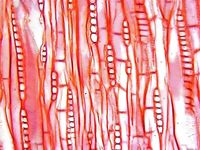 Tangential section